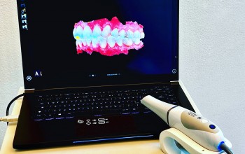 L'impronta dentale digitale con scanner intraorale